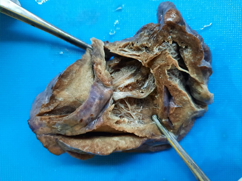 Fig 1 Gross 